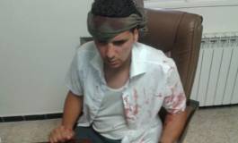 Ksar El Boukhari : un jeune tabassé par les gendarmes