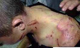 La Tunisie peine à se débarrasser de la torture