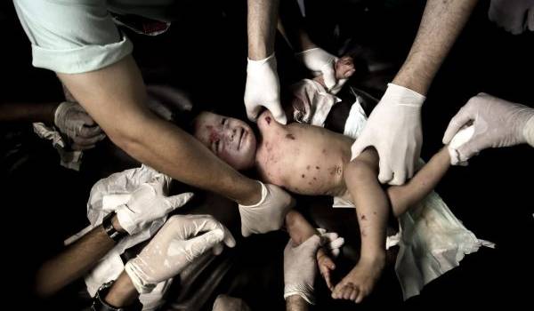 Les civils, surtout les enfants, sont les premières victimes de la guerre que mène Israël à Gaza.