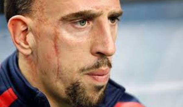 Ribéry ne portera plus le maillot de l'équipe de France.