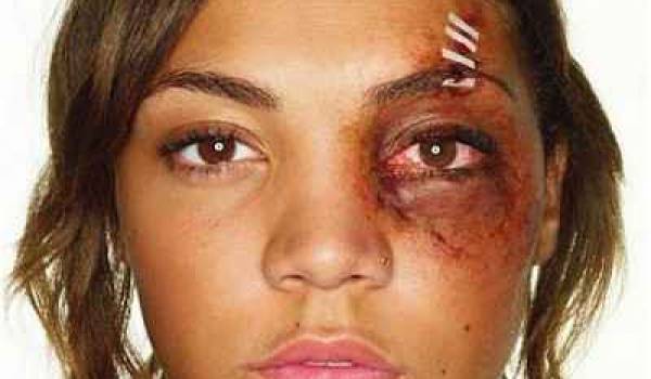 Jusqu’à quand ces expéditions punitives contre les femmes?