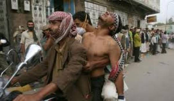 Le pouvoir joue la montre au détriment de la rue yéménite déjà ensanglantée.