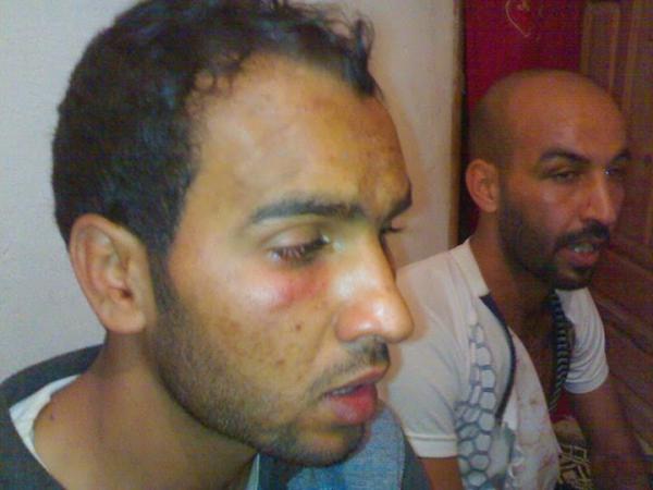 Jusqu’où ira la sauvagerie des agents de l’ordre ?